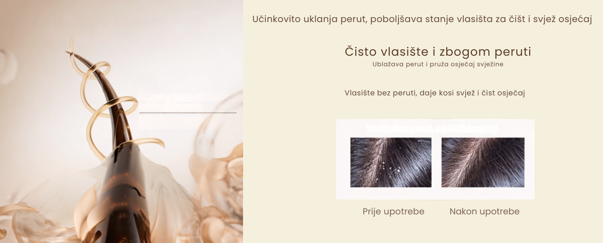 Prije i poslije korištenja šampona protiv peruti